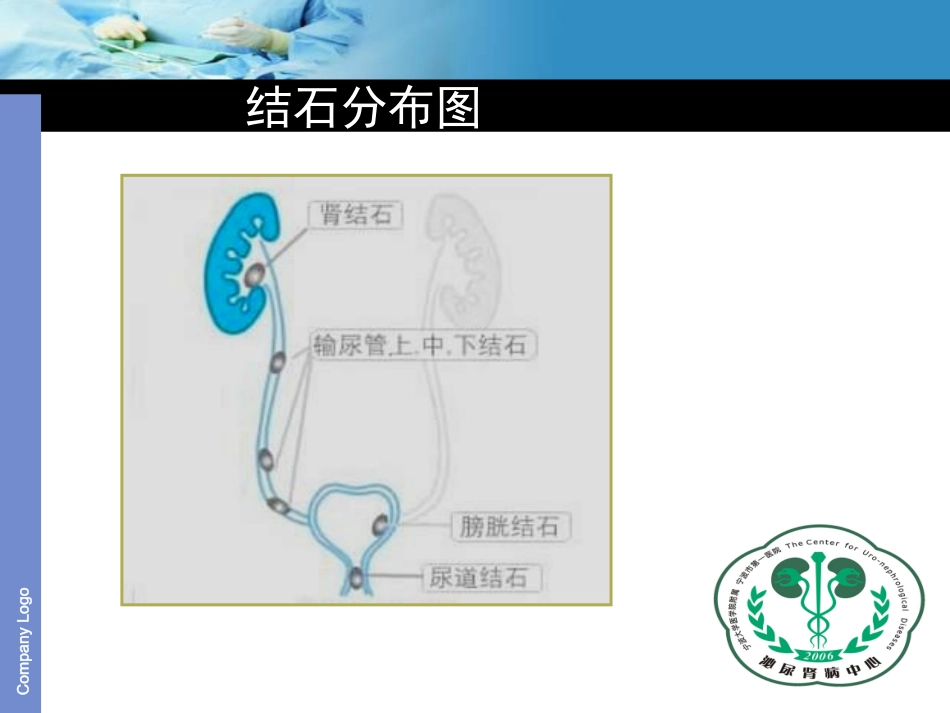 输尿管软镜及硬镜碎石的护3分析_第3页