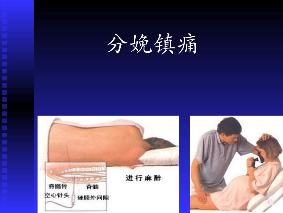 田英刚-分娩镇痛_第1页