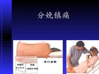 田英刚-分娩镇痛