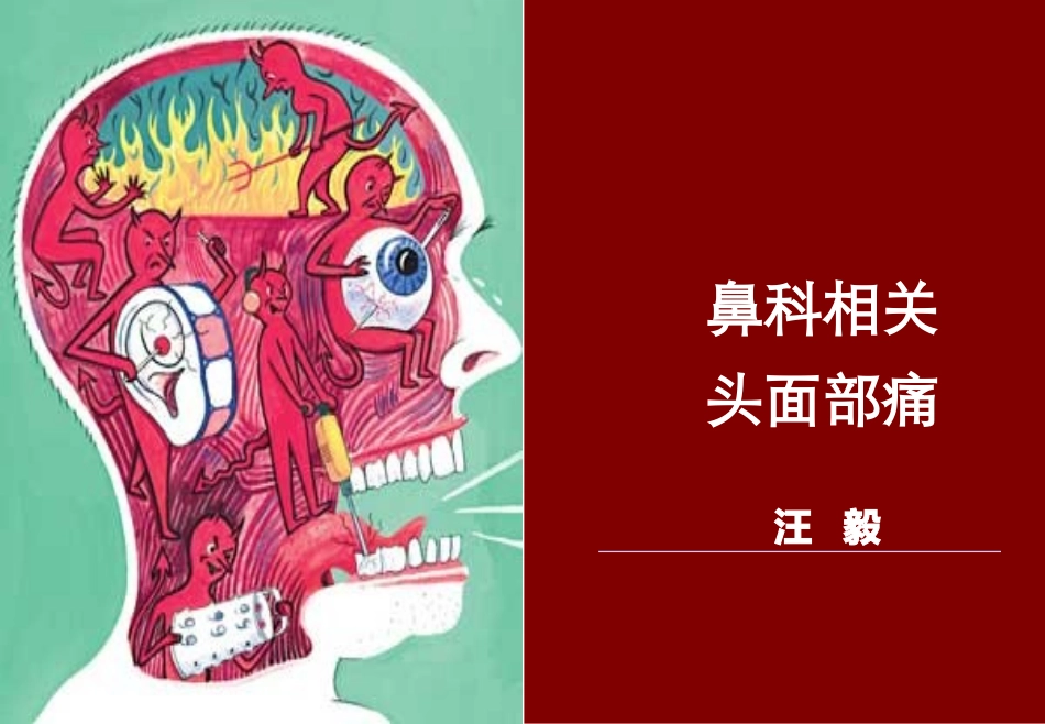 头痛与面部疼痛_第1页