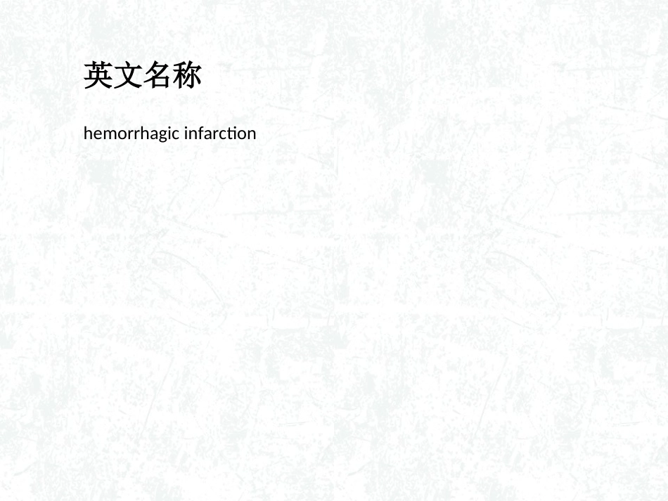 出血性脑梗死_第2页