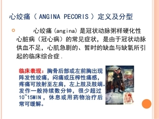 抗心绞痛药老师的
