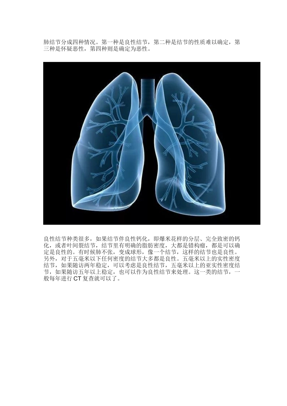 如何判断肺结节是良性还是恶性？_第1页