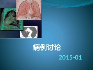 孤立性肺结节