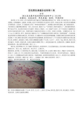 恶性黑色素瘤多发转移1例