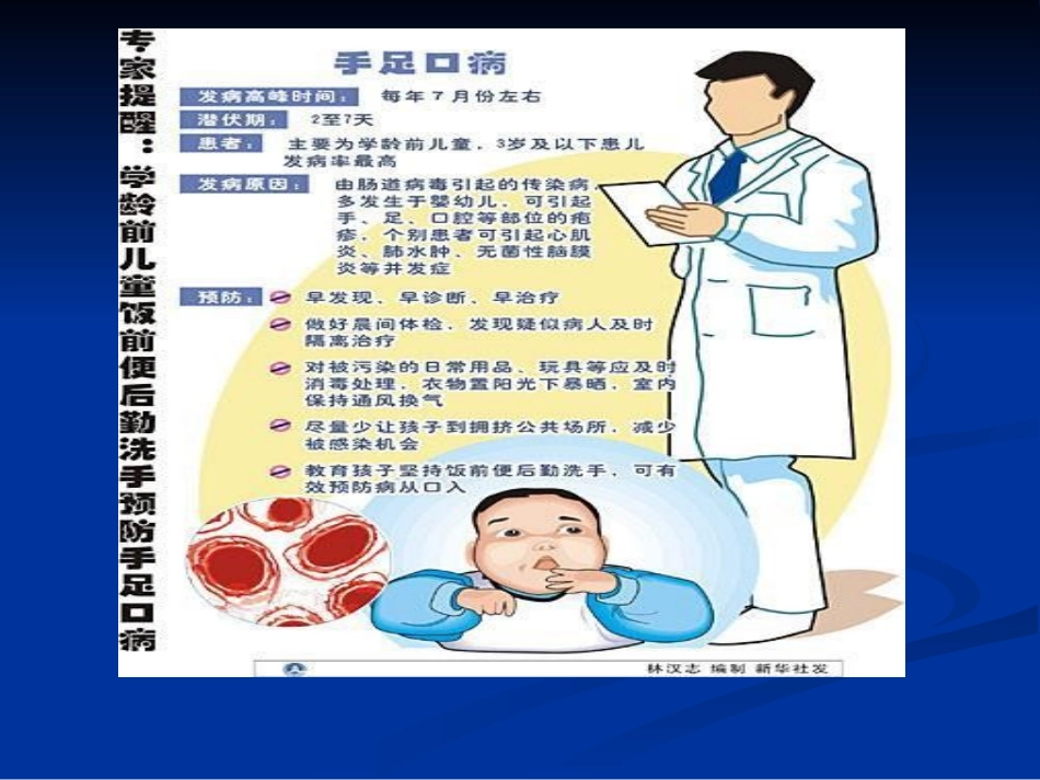 手足口病诊治_第2页