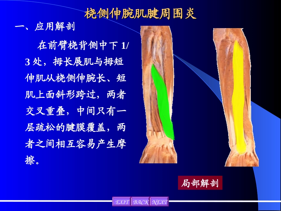 桡侧伸腕肌腱周围炎_第1页