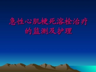 急性心肌梗死溶栓