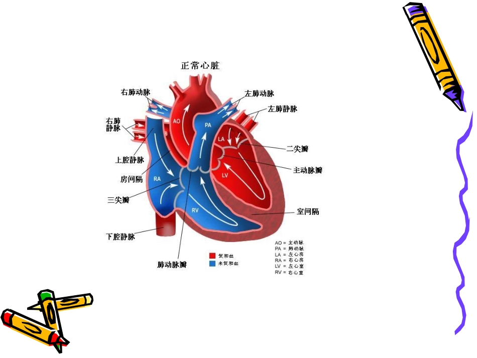 二尖瓣置换术后护_第3页