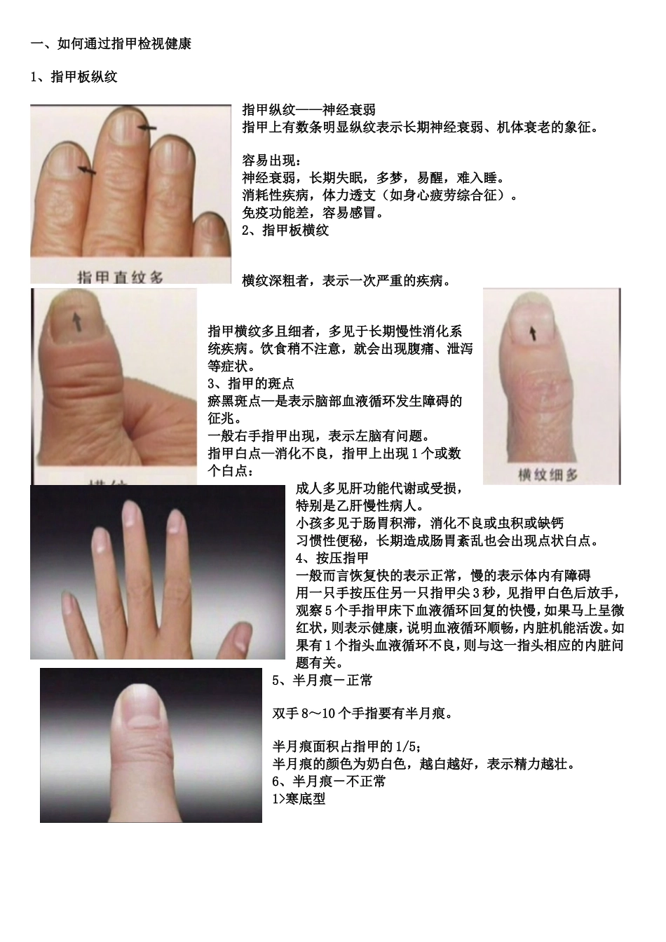通过指甲检视健康_第1页