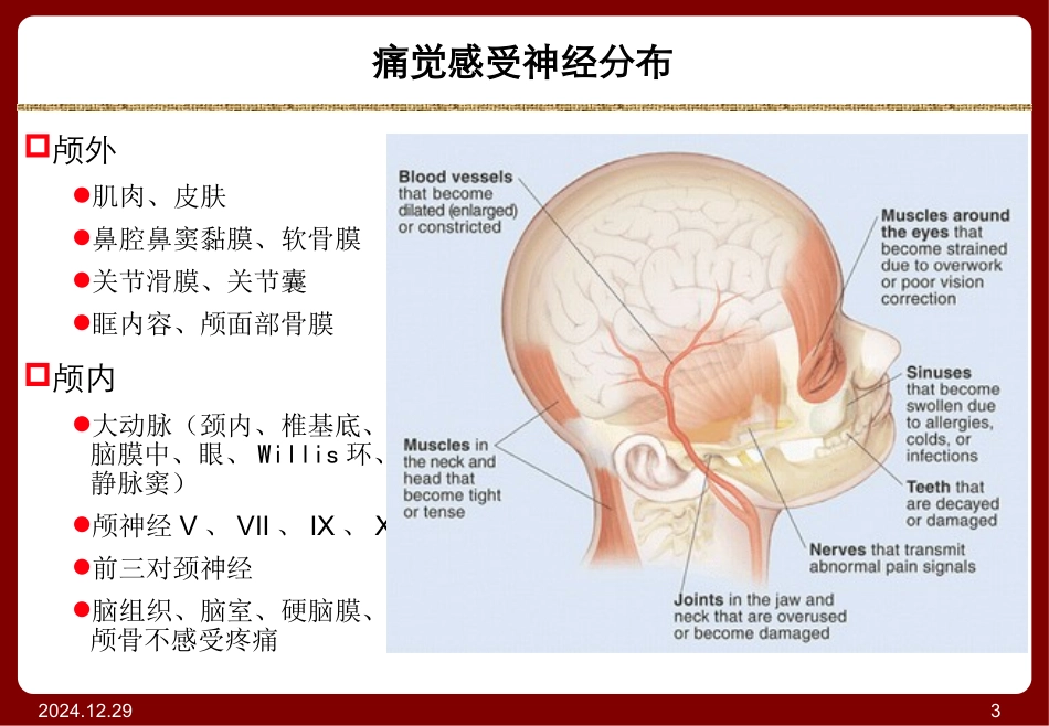 头痛和面部疼痛_第3页
