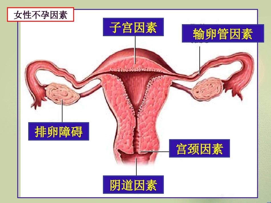 输卵管通液术2015.3.31_第3页