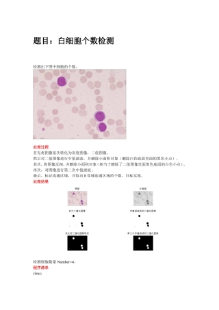 图像处理——细胞个数检测(Matlab)