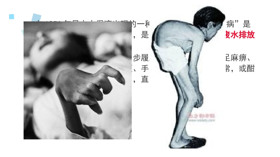 世界八大公害事件之一——水俣病_第2页