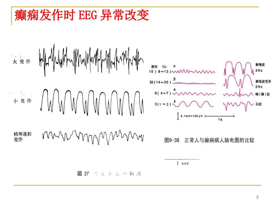 抗癫痫药hjr2014-2015-1_第3页