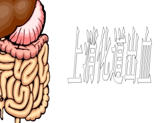 上消化道大量出血