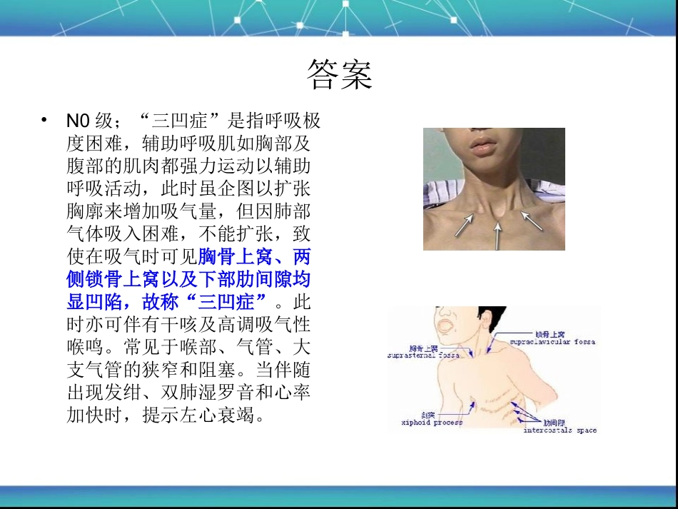 喉梗阻-Microsoft-PowerPoint-幻灯片_第2页