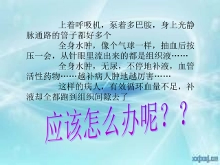 毛细血管渗漏综合征