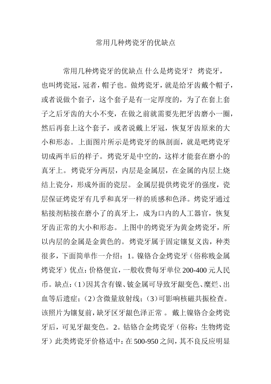常用几种烤瓷牙的优缺点_第1页