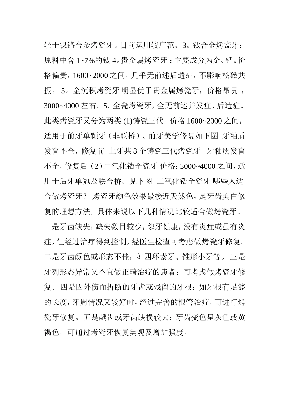 常用几种烤瓷牙的优缺点_第2页