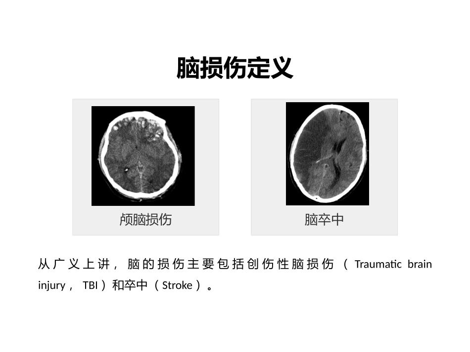 NGF与认知功能障碍_第2页