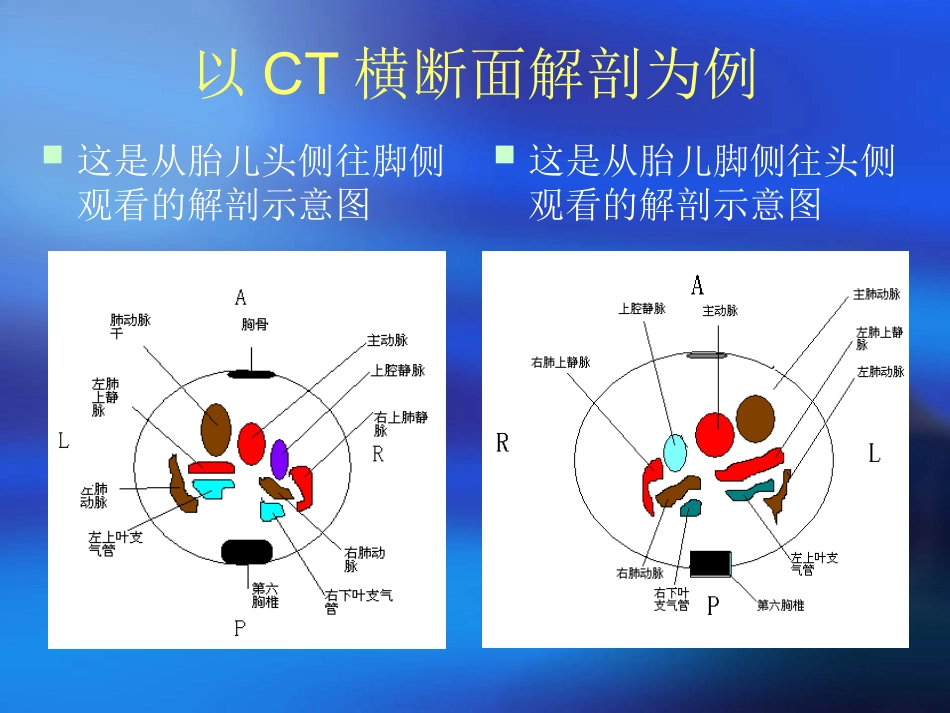 胎儿心脏检查步骤_第3页