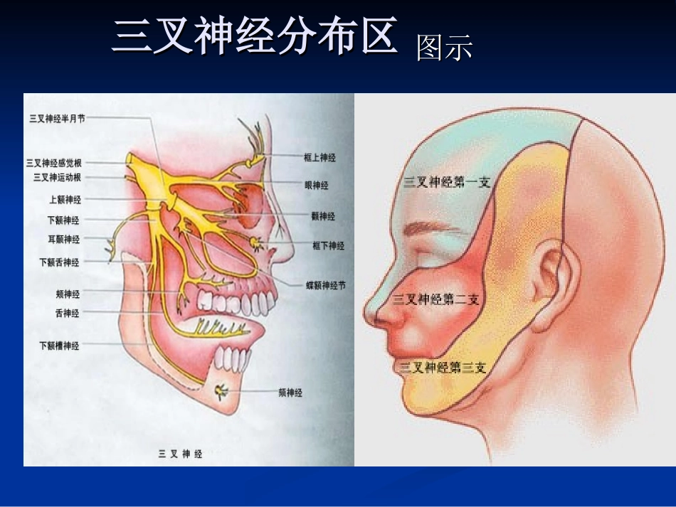 三叉神经痛(讲)_第3页