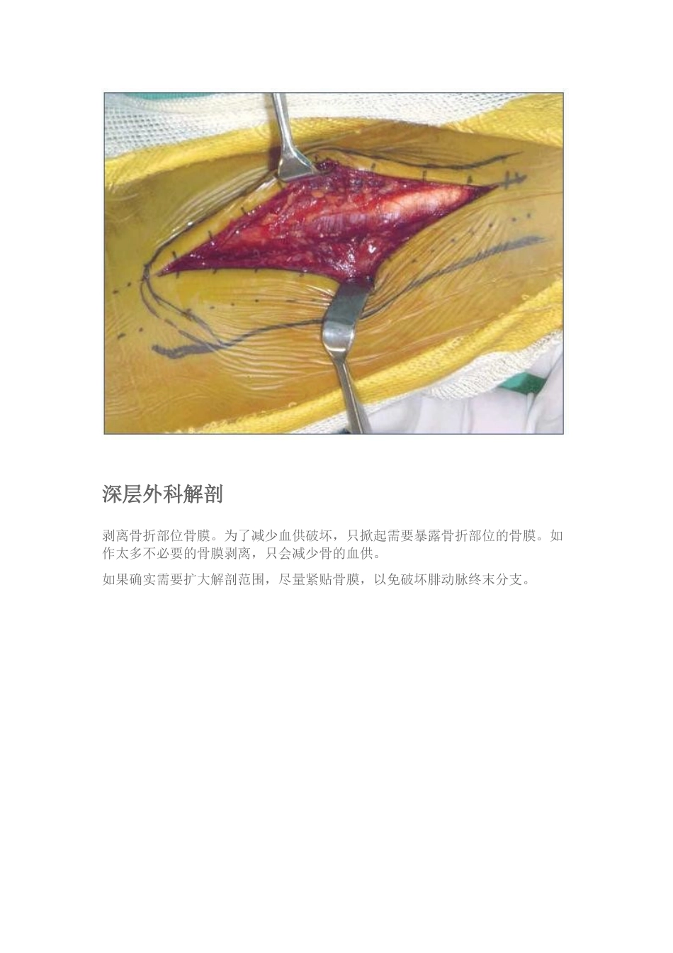 外踝及腓骨下段手术入路_第3页