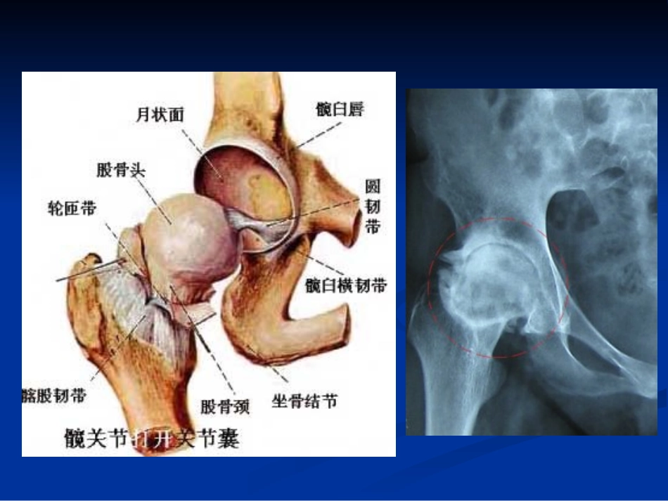 浅析股骨头无菌性坏死浅论_第2页