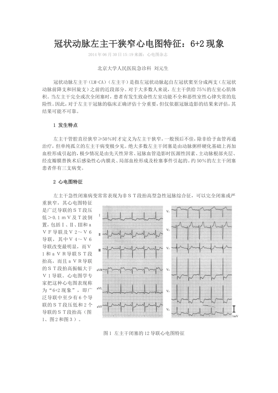 冠状动脉左主干狭窄心电图特征：6+2现象_第1页