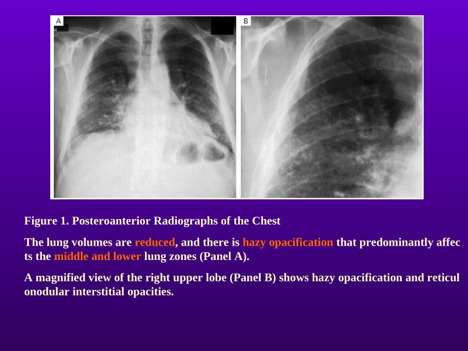 呼吸困难、紫绀_第3页