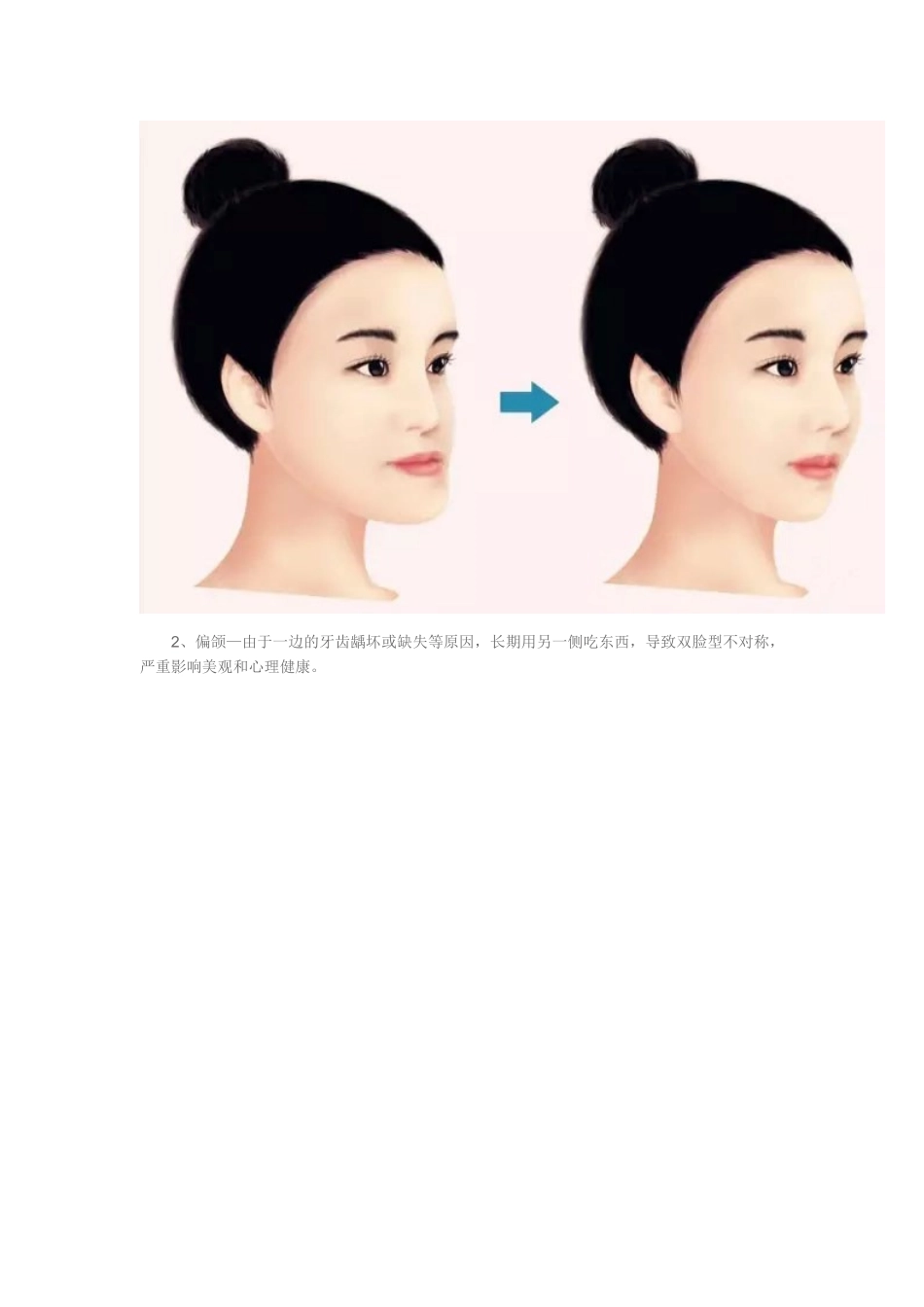 家长注意：必须在12岁前处理的10种儿童牙颌畸形!_第2页