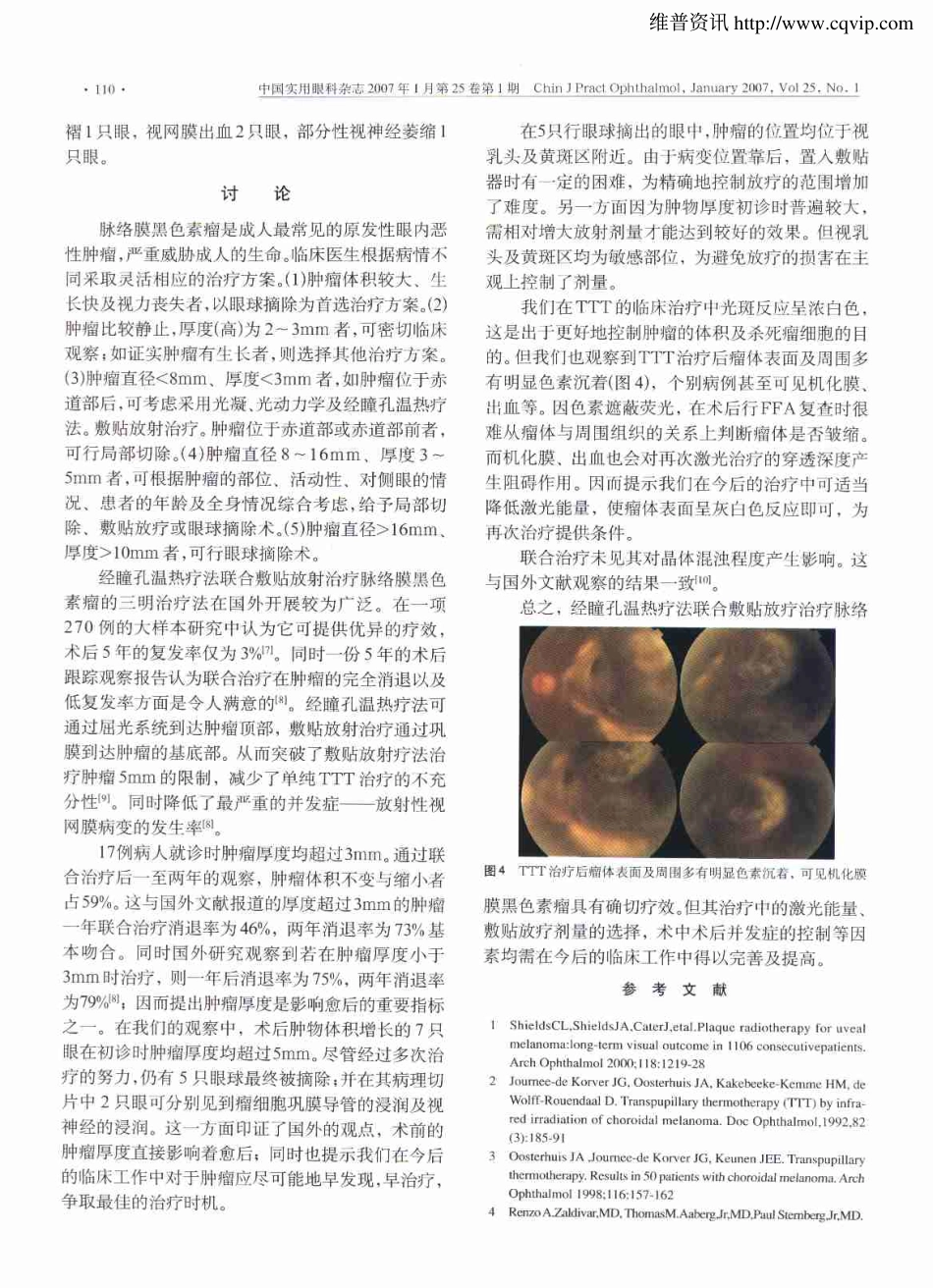 经瞳孔温热疗法联合敷贴放疗治疗脉络膜黑色素瘤的临床观察-http_第3页