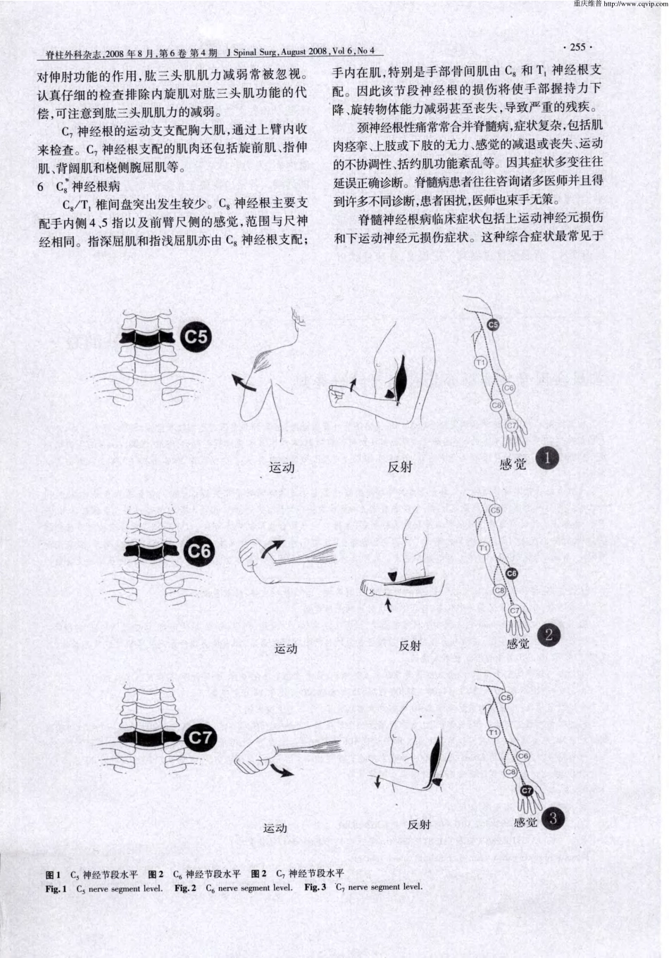 颈椎神经根性痛的再认识_第2页