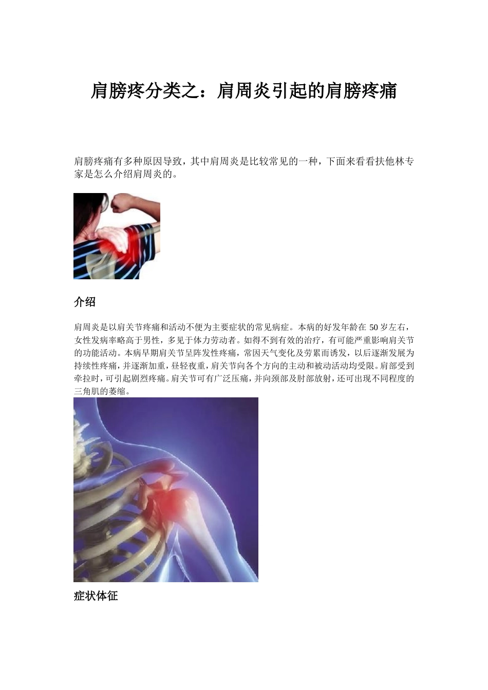 肩膀疼分类之：肩周炎引起的肩膀疼痛_第1页