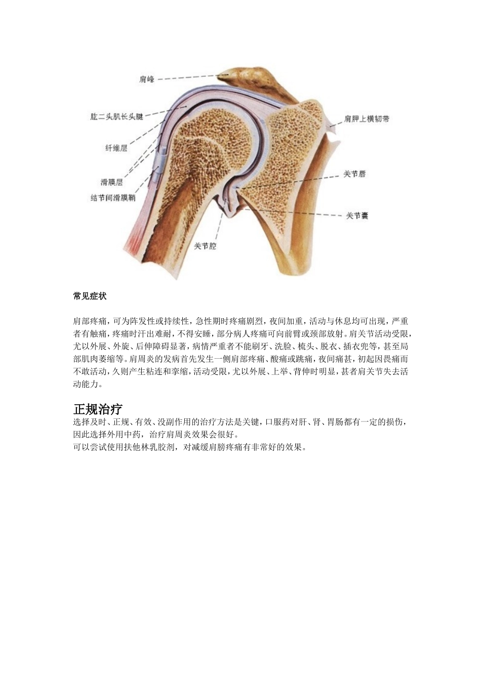 肩膀疼分类之：肩周炎引起的肩膀疼痛_第3页