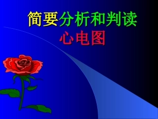 简要心电图分析
