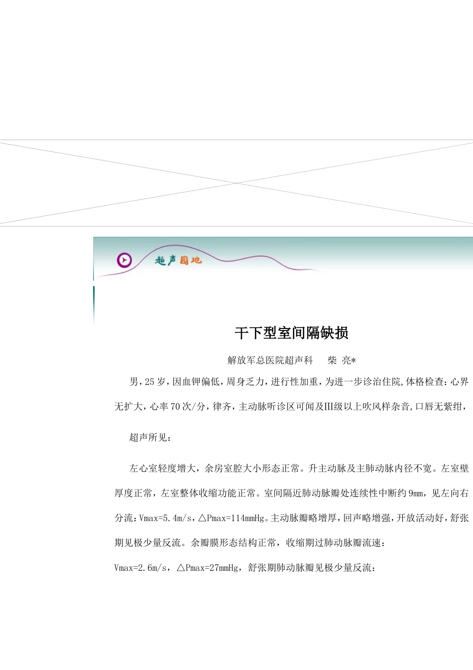 干下型室间隔缺损_第1页