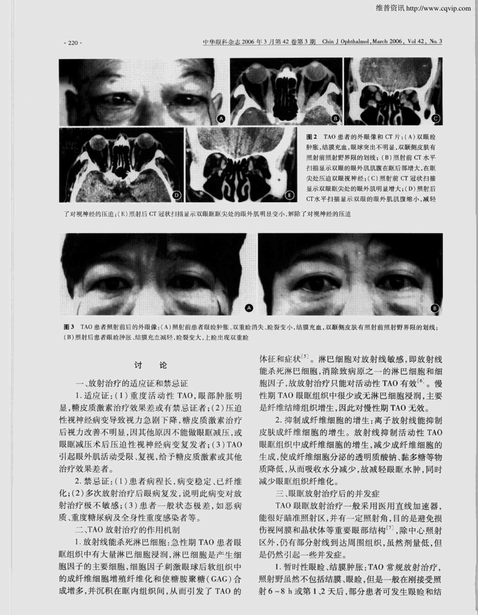 甲状腺相关眼病的放射治疗_第3页