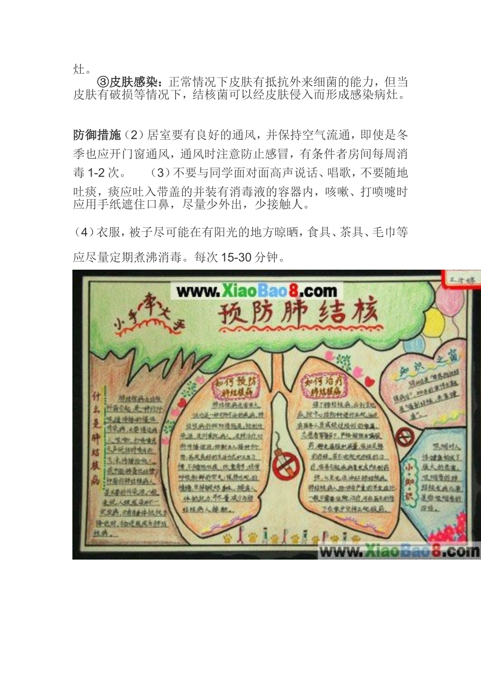 结核病是由结核分枝杆菌引起的慢性传染病_第2页