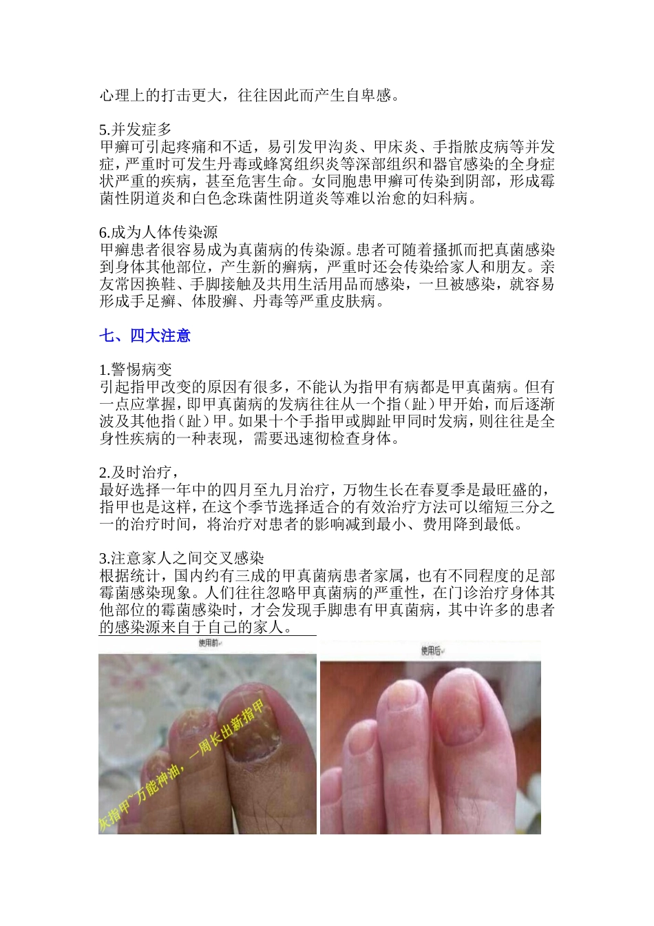 灰指甲的治疗方法_第3页