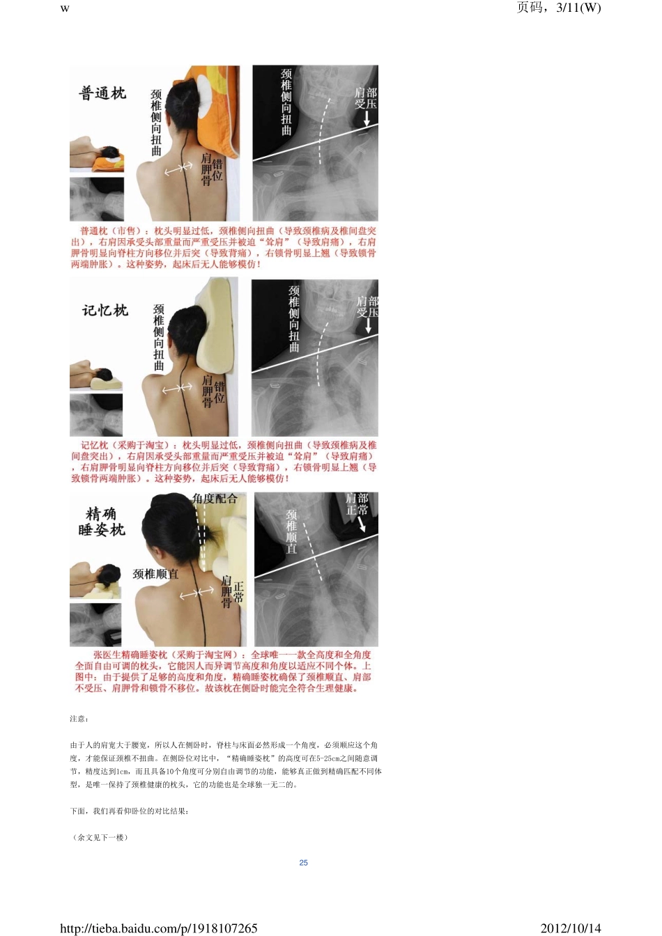 解决颈椎病图解_第3页