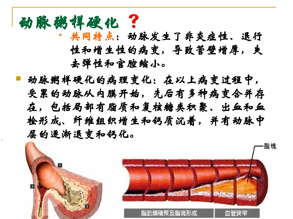 冠心病 (1)_第3页