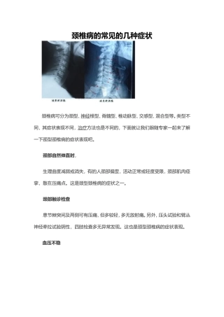 颈椎病是什么症状