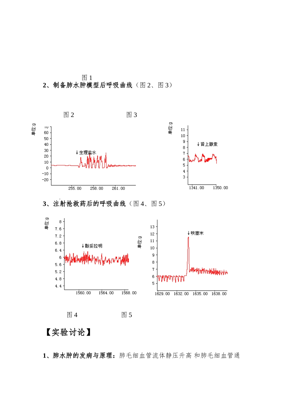 家兔急性肺水肿模型的建立及药物抢救_第2页