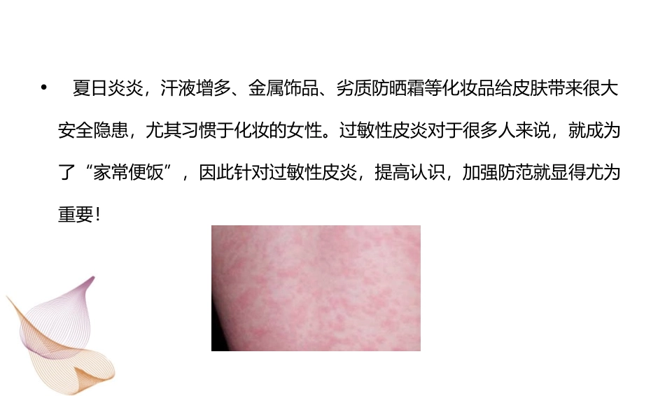 过敏性皮炎症状_第2页