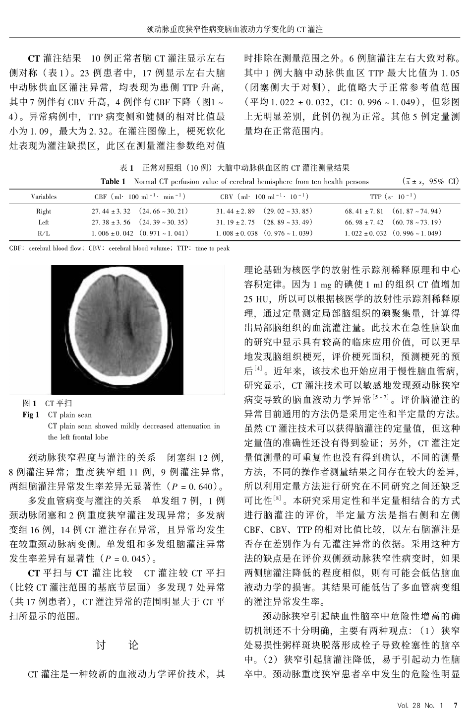 颈动脉重度狭窄性病变脑血液动力学变化的 #$灌注_第3页