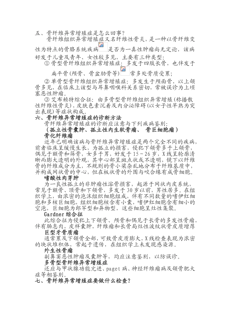 骨纤维异常增殖症_第2页