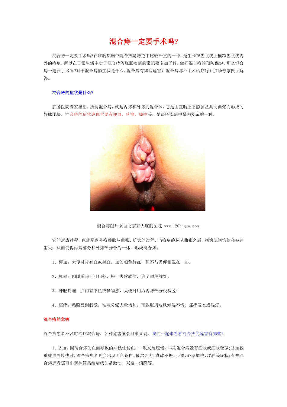 混合痔一定要手术吗_第1页