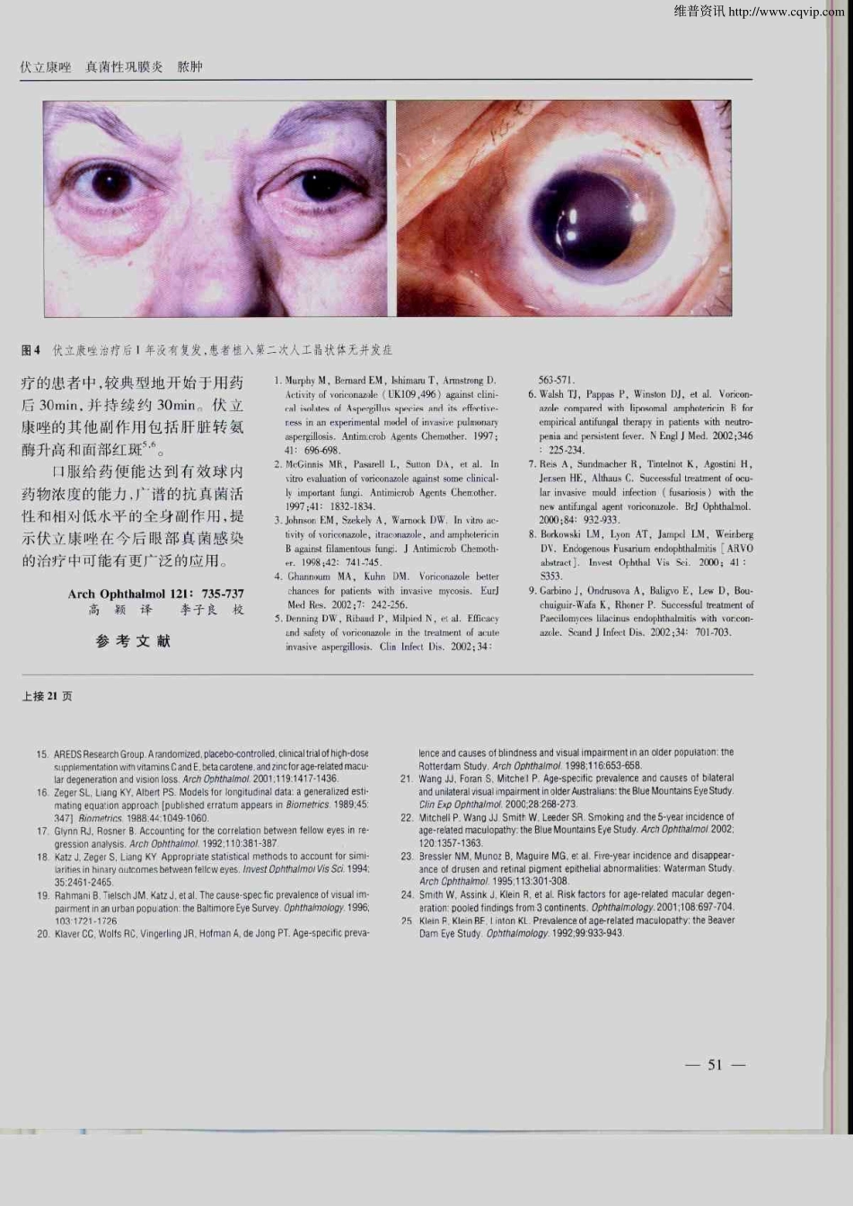 伏立康唑治疗巩膜扣带感染导致的真菌性巩膜炎及球壁外脓肿_第3页